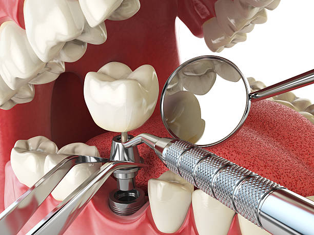 Best Emergency Care for Gum Disease in North Shore, VA