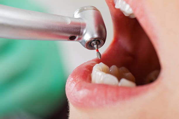 Best 24-Hour Emergency Dental Care in North Shore, VA